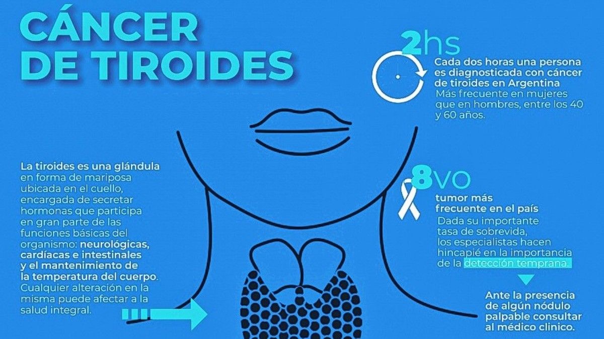 C Ncer De Tiroides Cada Dos Horas Una Persona Es Diagnosticada En La