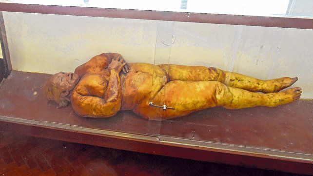 conservaci&oacute;n. El cuerpo de la mujer puede verse en el Museo de Ciencias Morf&oacute;logicas de la c&aacute;tedra de anatom&iacute;a normal.