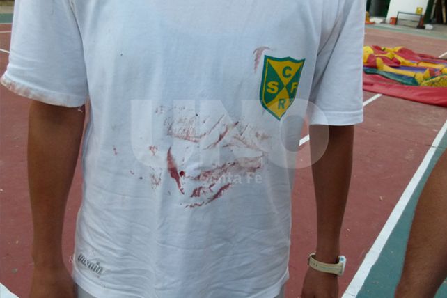 Sigue en grave estado la nena baleada en la cabeza en Regatas