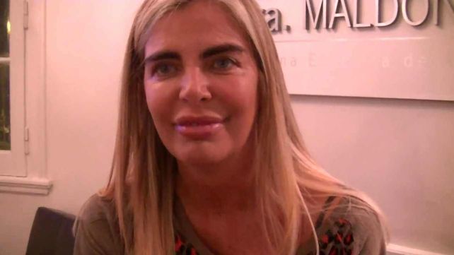 Raquel Mancini evoluciona favorablemente y salió de terapia intensiva