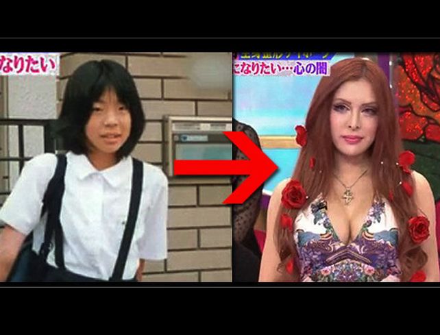 Se sometió a 30 cirugías para dejar de ser japonesa