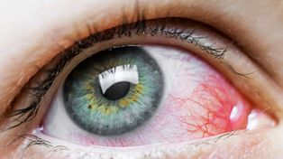 Revelan que las células de los ojos pueden ser infectadas por el coronavirus