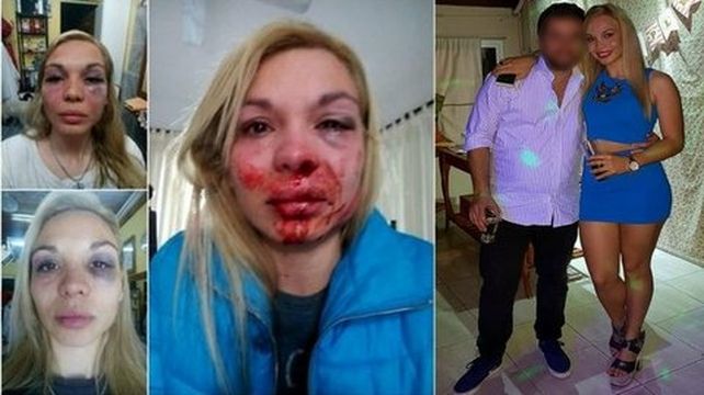 Fedra Feresín: Tuve miedo de morir