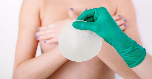 ¿Las rosarinas van por más o quieren lolas naturales?&nbsp; 