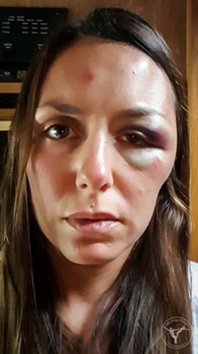 lesiones. El rostro de Andrea muestra las secuelas del ataque.