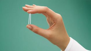 El nuevo anticonceptivo de acción prolongada se implanta bajo la piel. Las adolescentes lo eligen cada vez más