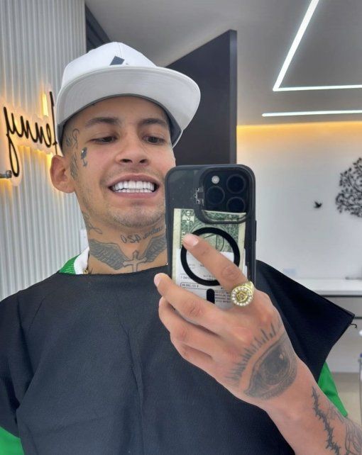 L-Gante y su nueva dentadura