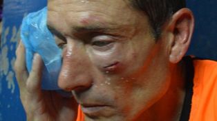 Peligra el Superclásico: Los árbitros irían al paro general por la agresión a Elichiri