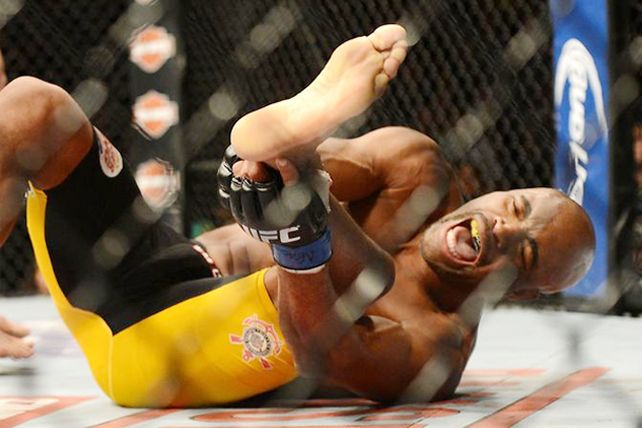 La impresionante lesión de Anderson Silva en la UFC