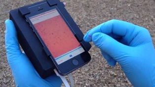 Un smartphone realiza un test de sangre en 2 minutos para detectar los parásitos más mortales