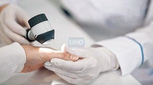 Melanoma, cáncer de piel: se diagnostican 1.700 casos por año
