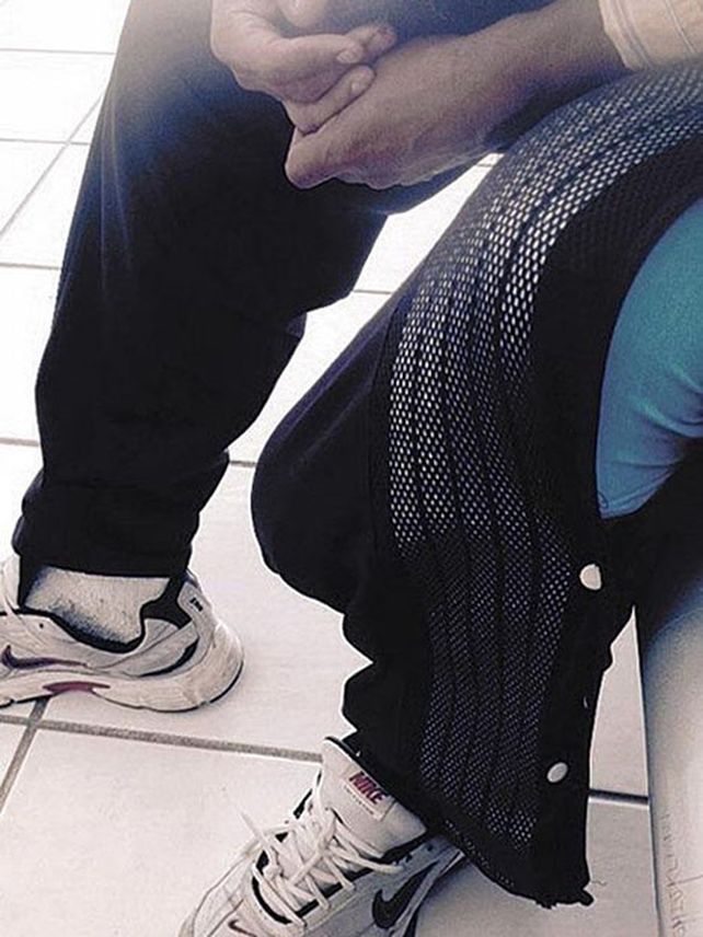 El hombre dice que su miembro lellega debajo de la rodilla.