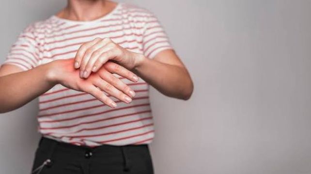 Las zonas más afectadas son dedos de las manos y pies y las orejas. Suelen ponerse rojas, picar y doler 