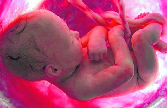 Precisión.&nbsp; Se pueden conocer patologías antes del nacimiento del bebé o en los primeros días de vida.