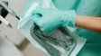 Entre los elementos que prohibió el Anmat figura este instrumento de esterilización usado en cirugías