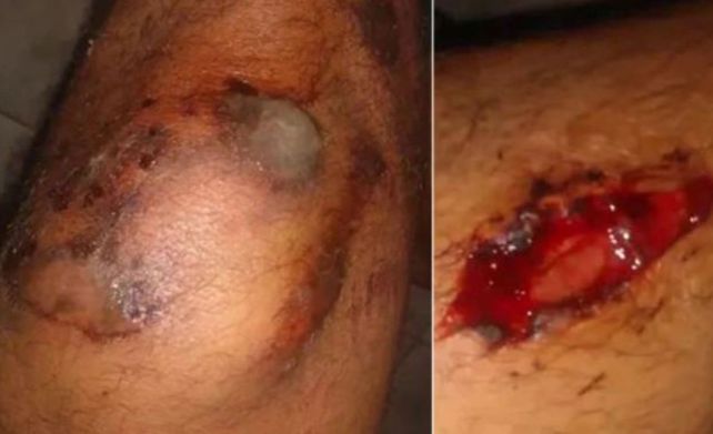 Una patota de rugbiers le dio una brutal paliza a un joven y casi lo matan