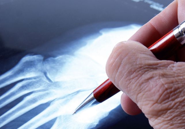 Las obras sociales unificaron posturas frente al conflicto con los traumatólogos