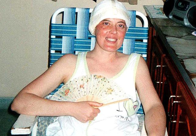 Salir adelante. La operación de Patricia fue de alto riesgo. (Foto: Gentileza Patricia Marino)