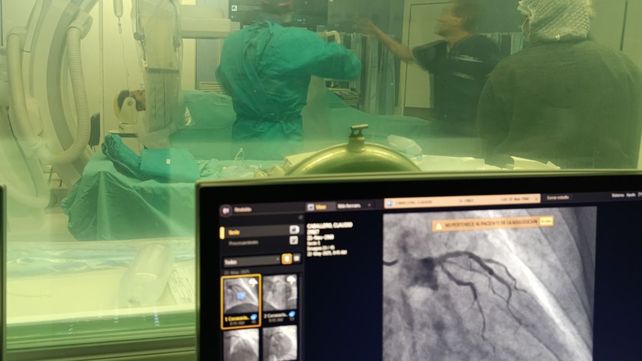 Hospital público de Santa Fe realizó una intervención inédita con un dispositivo que mejora la seguridad cardíaca