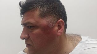 Secuela de la barbarie.&nbsp; Arnaldo Quiroga recibió una patada en la cabeza y terminó hospitalizado.
