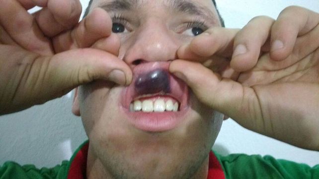 Ferreyra expulsó a Muñoz del club Quinto Cuartel y este lo agredió con un golpe de puño.&nbsp; 