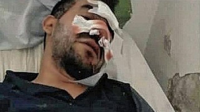 El joven se halla internado en Arroyo Seco tras la brutal paliza