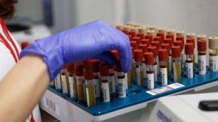 Los bioquímicos no escapan a la realidad inflacionaria de la Argentina
