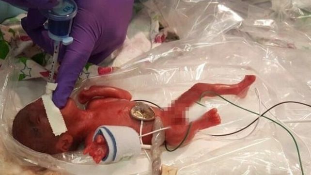 Un milagro. Así calificó una enfermera la recuperación de Saybie.