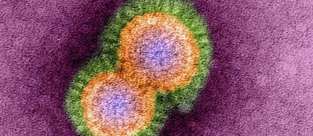 Dos investigaciones mostraron que basta que el virus H5N1 experimente cinco cambios para que pueda comenzar a transmitirse a través de partículas en el aire y a contagiarse entre humanos.
