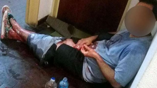 Un cuaderno probaría que la joven que castró a su amante lo había planeado como venganza