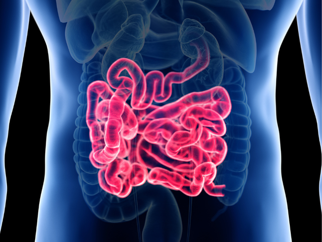 Enfermedad Inflamatoria Intestinal