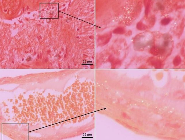 La investigación revela que los microplásticos y los nanoplásticos se acumulan a niveles más altos en el cerebro que en el hígado y el riñón.