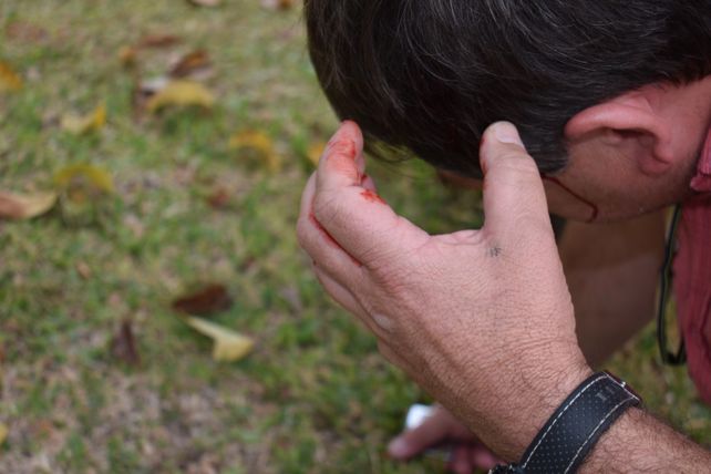 Atacaron con un fierro a un periodista de Santa Elena