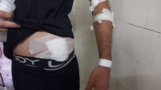 Robo de motos con extrema violencia en Santa Fe: hubo dos casos graves en pocas horas