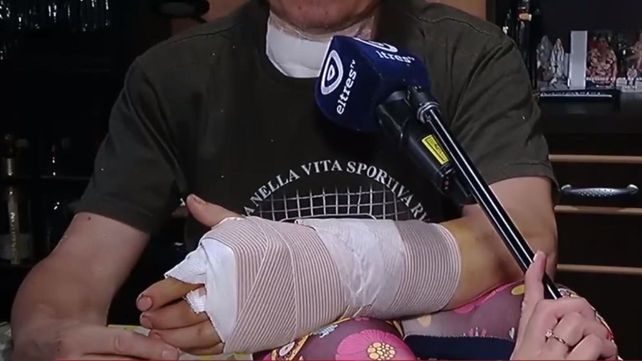 El duro relato de Miguel, el mozo baleado: Estoy asustado y angustiado