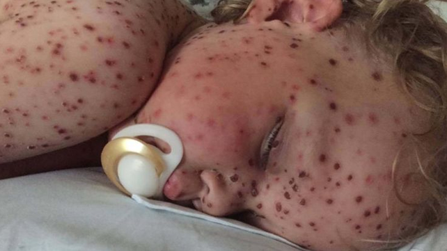 Las páginas de Facebook que usan fotos de niños enfermos para estafar