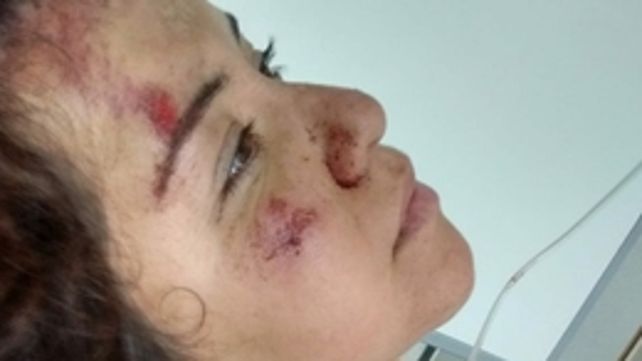 Secuelas del choque. Marianela estuvo dos días internada y hoy se aloja en la casa de una amiga rosarina.