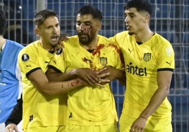 Un jugador de Peñarol recibió un corte tras ser agredido por un hincha de Central Un jugador de Peñarol recibió un corte tras ser agredido por un hincha de Central