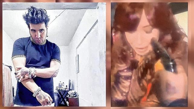 Identificaron al agresor de Cristina Fernández por un tatuaje nazi