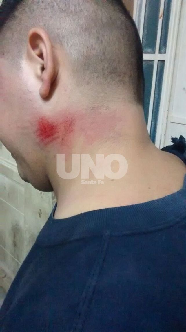 B° Yapeyú: frustraron pueblada para rescatar presos y hubo cinco heridos