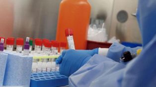 Pandemia: hubo tres muertos y 143 nuevos contagios en el país