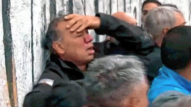 Sergio Berni quedó malherido