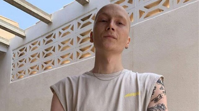 Falleció Charlie, el tiktoker español que mostró con humor su lucha diaria contra el cáncer