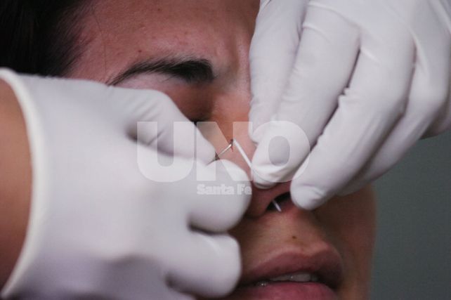 Perforación. Un arito en la nariz habría sido la puerta entrada del germen que puso en riesgo la vida de la joven.