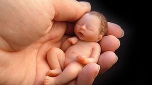El único aborto con el que estamos a favor es el aborto no punible