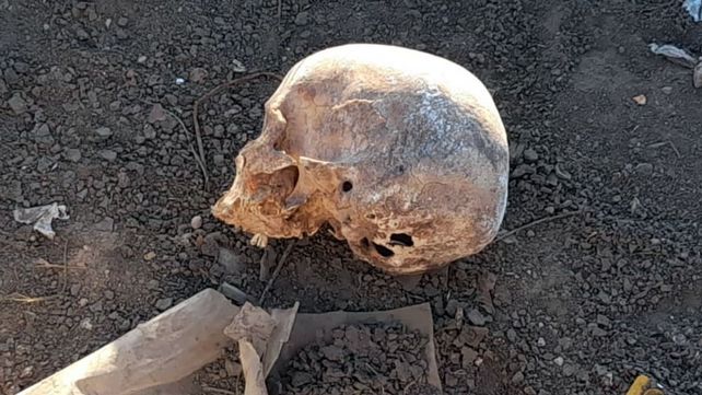 El cráneo encontrado en Colonia Avellaneda yacía junto a piezas dentarias y restos de yeso.&nbsp;
