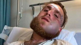 Así quedó Jake Paul tras el brutal nocaut que le propinó Anthony Joshua