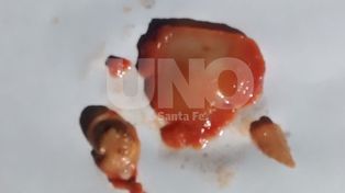 Análisis de muestra de puré de tomates: se debió a un desarrollo macroscópico de mohos