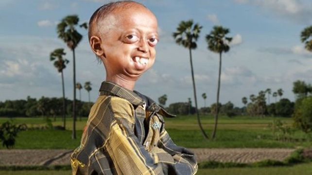 Un nene de 14 años que tiene el cuerpo del de un hombre de 112
