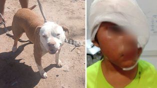 La niña de 8 años sufrió la mordedura en su rostro cuando jugaba con el animal en la casa de una amiguita